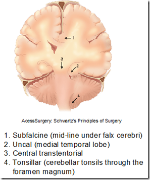brain coma stem death herniation lesion strokes hematoma mass type